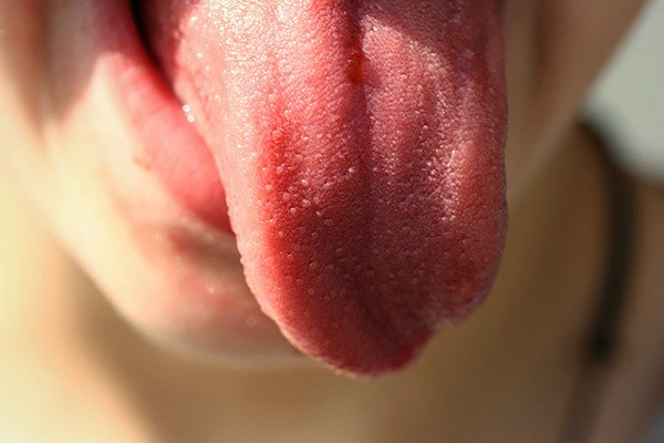 健康的な子供の舌